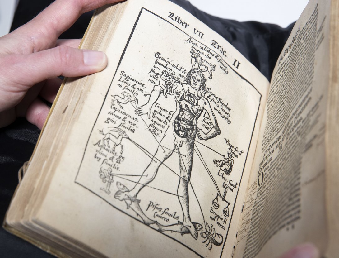 A rare book showing a medical illustration of a person with their organs on show and descriptive tags included.