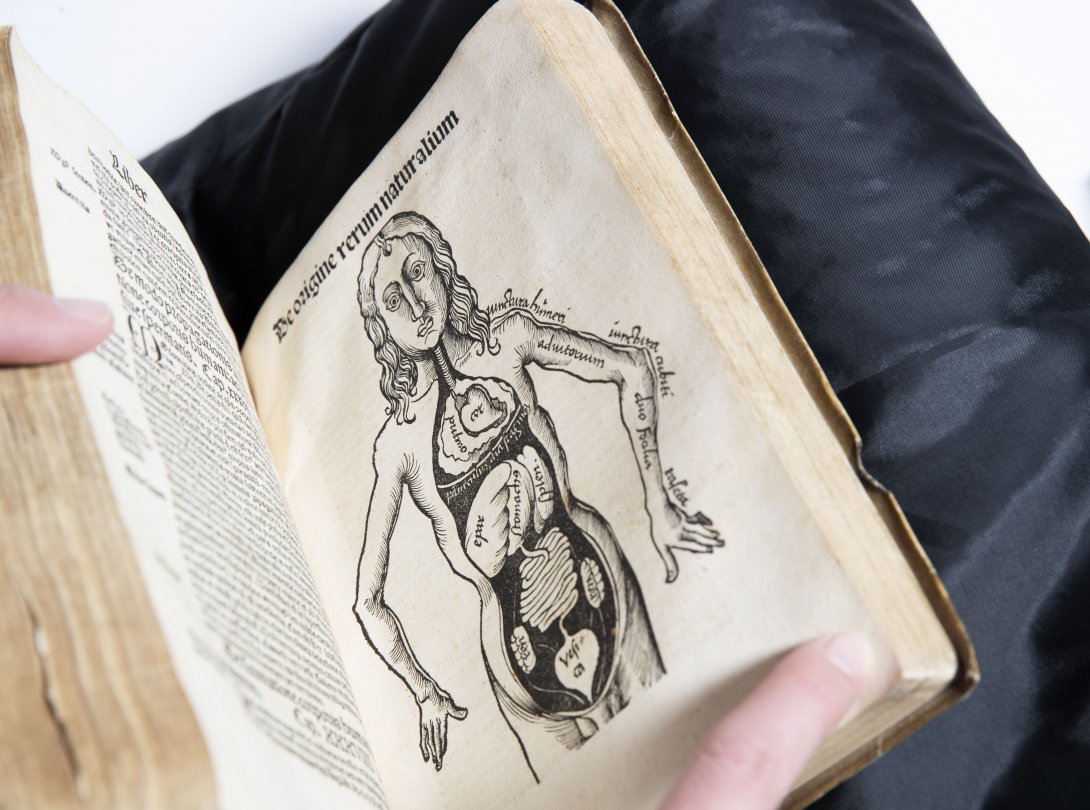 A rare book opened to a medical illustration of a person with their organs displayed.
